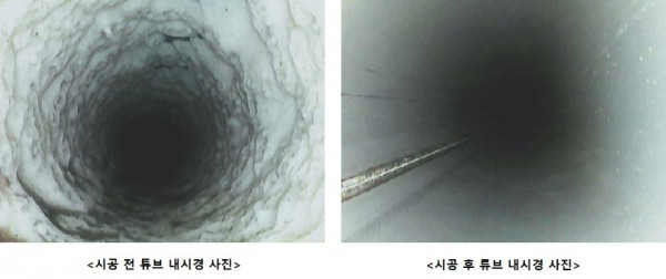 튜브내시경1.jpg