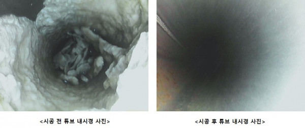 튜브내시경2.jpg